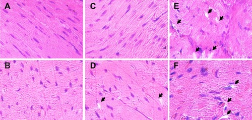 Figure 6 Histopathology of myocardium from experimental animals. Representative images of left ventricular histology from experimental animals stained with hematoxylin and eosin are shown.Notes: (A, B) The cardiac myofibrils from control rats exhibited regular arrangement of thick and thin myofilaments. (C, D) INP treatment did not alter the morphology of myocardium of rats significantly, although very few isolated vacuoles are present. (E, F) Myofibrillar loss and formation of variable-sized cytoplasmic vacuoles in the myocardium of rats treated with 50 mg/kg dose of free imatinib mesylate. Vacuole structures are indicated with black arrows.Abbreviation: INP, imatinib mesylate-loaded poly(lactide-co-glycolide) nanoparticle.
