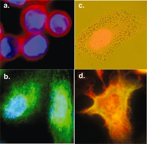Figure 3 Color fluorescence images of human prostate cancer cells stained with multicolor QD-antibody conjugates. (a) Staining of membrane antigen E-cadherin with QD655 (emission wavelength = 655 nm); (b) staining of cytoplasmic antigen vimentin with QD525; (c) staining of nuclear antigen HIF1alpha with QD655; and (d) multiplexed staining of tumor antigens with QD525 (labeling RANKL), 565(N-cadherin), 605(EF1aplha), 655(E-cadherin) and 705 (vimentin). The cell nuclei were counterstained blue with DAPI in (a) and (b).