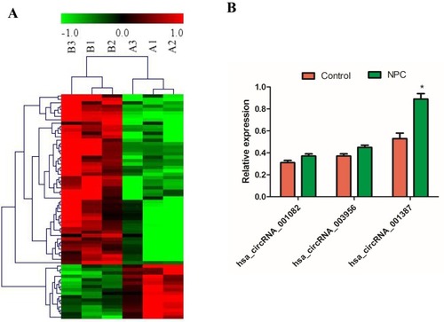 Figure 1 Selection and detection of circRNA expression variance. (A) shows 50 circRNA with the most significant expression variance. Red indicates high expression while green shows low expression. A1, A2 and A3 are control groups. B1, B2 and B3 are NPC groups. The first 50 are high expression and the bottom 15 are low expression. (B) shows the qRT-PCR results of three circRNAs. *P<0.05, compared with control group. All experiments were repeated three times.