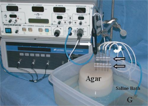 Figure 1. Experimental apparatus: An internally-cooled RF electrode (white arrow) has been inserted into an NaCl gel filled well within an Agar phantom, placed in a saline bath at a fixed distance from the grounding pad (G). Thermocouple probes (white curved arrow) have been inserted to measure temperature. An acrylic guide (open arrow) ensures proper positioning of the thermocouple. The RF generator and a temperature measurement device can be seen in the background.