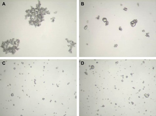 Figure 1 Representative images of particles of Triesence® (A, C) and Kenalog®-40 (B, D). In (A and B), samples were diluted in buffered salt solution. In (C and D), samples were diluted in a solution containing 1 g/L Triton X-100. Samples were photographed with a Nikon Labophot polarizing light microscope with Clemex Vision Lite 4.0 software. Images were taken at a magnification of 400×.