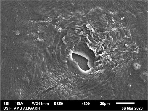 Figure 2. Scanning electron microscopy showing the perineal pattern of M. incognita. The high squared dorsal arch, wavy striae are key features of M. incognita.