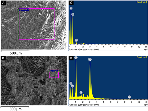 Figure 2 SEM images and EDX analysis of general cloth and microcurrent cloth. SEM image of (A) general cloth and (B) Zn/Ag printed microcurrent cloth. EDX analysis of (C) general cloth and (D) Zn/Ag printed microcurrent cloth. Scale bar: 500 μm.