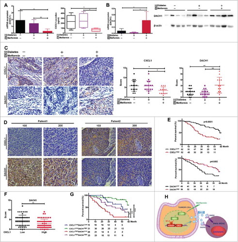 Figure 7. DACH1/CXCL1 regulation of PMN-MDSC accumulation in patients with ESCC undergoing metformin treatment could improve prognosis. CXCL1 expression was verified in tumor tissues and serum from patients with ESCC using qRT-PCR and ELISA. (B) DACH1 expression in patients with ESCC treated with metformin was measured by qRT-PCR and western blotting. (C) Paired analysis of CXCL1 and DACH1 expression in patients receiving metformin treatment. (D) Two representative ESCC samples showing expression patterns of CXCL1 and DACH1. (E) Overall survival of patients with ESCC showing high and low CXCL1 (n = 104; top) and DACH1 expression (n = 105, bottom), presented as a Kaplan-Meier curve. (F)) Expression of DACH1 and CXCL1 was detected using immunohistochemistry. Data show distribution of DACH1 expression in CXCL1-high and CXCL1-low groups. (G) Overall survival of patients with ESCC displaying differential expression of DACH1 and CXCL1, presented as a Kaplan-Meier curve. (H) Schematic representation of the mechanisms of the anti-tumor effects of metformin. *P < 0.05; **P < 0.01; ***P < 0.001; ****P < 0.0001.