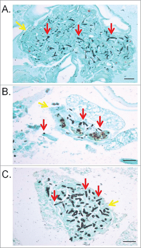 Figure 3. G. mellonella internal structures affected by trichorporonosis caused by T. asahii 07 (A), T. asteroides 01 (B) or T. inkin (C) 2 days postinfection. The red arrows point the fungal cells and the yellow arrows point G. mellonella tissues. GMS stain. Bars, 20 μm. Magnification, x400.