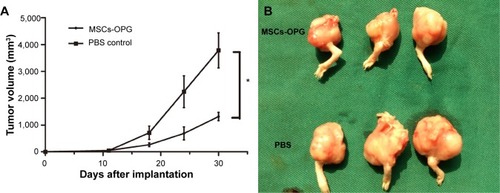 Figure 6 Volume of tumor after treatment with MSCs-OPG or PBS solution.
