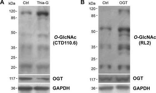 Figure 1 O-GlcNAcylation was up-regulated by Thiamet-Gtreatment and OGT overexpression.