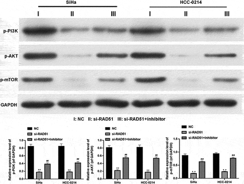 Figure 6. miR-125a clearly decreases PI3K and AKT phosphorylation and mTOR and IKK expression by targeting Rad51 in SiHa and HCC-0214 cells.