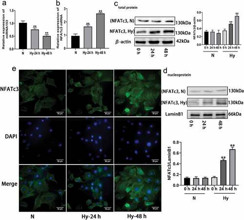 Figure 5. Effect of hypoxia on the expressions of miRNA153 and NFATc3 in PASMCs. (a, b) The mRNA expression of miRNA153 and NFATc3 in PASMCs determined by RT-qPCR. (c) Western blot analysis of NFATc3 total protein in PASMCs. (d) The protein from nucleus of PASMCs analyzed with western blotting. (E)Immunofluorescence images showing translocation of NFATc3 (green) into DAPI-stained nuclei (blue) in normoxia and hypoxia treated PASMCs (400× magnification). Comparisons were performed using one-way ANOVA followed by Dunnett’s post hoc test. *P < .05, **P < .01 vs hypoxia 0 h group. The results are represented as the mean ± SEM. N, normoxi Hy, hypoxia; miRNA153, microRNA153; PASMCs, pulmonary arterial smooth muscle cells; RT-qPCR, quantitative real-time polymerase chain reaction; NFATc3, nuclear factor of activated T cell isoform c3; SEM, standard error of mean.