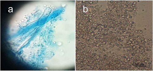 Figure 5. (a) Picture of basidia with spores attached to sterigmata. (b) Globular to subglobular basidiospores