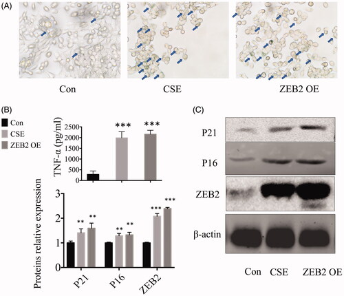 Figure 4. ZEB2 caused cellular senescence and inflammatory responses. (A) SA-β-GAL staining of cells. (B) Cytokine (TNF-α) levels in cell culture supernatants. (C) Western blot analysis of P16, P21, and ZEB2 protein expression in the cells. **p < .01 ***p < .001 versus control group.