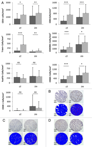 Figure 1. Distribution of immune cells in MSS and MSI colorectal cancers. (A–D) Comparison of the density of immune cells in human colorectal cancers with microsatellite stability (MSS; black bars) and microsatellite instability (MSI; gray bars). (A) The intratumoral (ct) and peritumoral (im) densities of CD3+, CD8+, T-Bet+, CD45RO+, FoxP3+, CD68+, and CD20+ cells were assessed by image analysis of tissue microarray spots. (B–D) Representative examples of staining are shown for CD8 (B), T-Bet (C), and FoxP3 (D); images show immunoperoxidase staining (×100) with the corresponding digital images (stained cells are represented in red). Statistical analyses were performed by non-parametric Mann-Whitney test; *P < 0.05; **P < 0.01; ***P < 0.001; ns, not significant