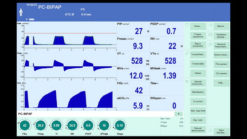 Figure 1. Patient with chronic obstructive airway disease (COPD) and airflow limitation. The flow and capnography waveform show persistent flow at the end of expiration.