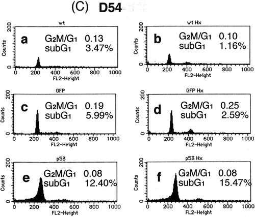 Figure 2. Cell cycle analysis of (a) U373-MG, (b) U251-MG and (c) D54 glioma cells after p53 over-expression, heat-shock treatment or their combination. (a) No treatment, (b) heat-shock treatment at 43°C for 2 h only, (c) Ad5CMV-GFP only, (d) Ad5CMV-GFP + heat-shock treatment at 43°C for 2 h, (e) Ad5CMV-p53 only and (f) Ad5CMV-p53 + heat-shock treatment at 43°C for 2 h.