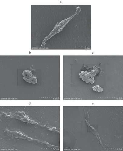 Figure 1. Scanning electron micrographs of the PC12 cells. (a) The control group; (b) 100.00 μg/mL carbaryl treated; (c) exposed to 100.00 μg/mL carbaryl for prior to 20.00 μg/mL GEN treatment for 12 h; (d) exposed to 100.00 μg/mL carbaryl for prior to 20.00 μg/mL DAI treatment for 12 h; (e) exposed to 100.00 μg/mL carbaryl for prior to 20.00 μg/mL combinations treatment for 12 h.Figura 1. Micrografía por barrido electrónico de las células PC12. (a) El grupo control; (b) 100,00 μg/mL de carbaril tratado; (c) expuesto a 100,00 μg/mL de carbaril previo a 20,00 μg/mL de tratamiento GEN durante 12 h; (d) expuesto a 100,00 μg/mL de carbaril previo a 20,00 μg/mL de tratamiento DAI durante 12 h; (e) expuesto a 100,00 μg/mL de carbaril previo a 20,00 μg/mL de tratamiento de combinaciones durante 12 h.