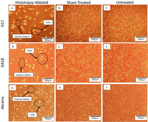 Figure 4. Qualitative cell assessment 24-h posthistotripsy ablation. Images of histotripsy-ablated, sham-treated, and untreated OS cells 24 h post histotripsy ablation. (A–C) D17, (D–F) D418, and (G–I) Abrams.