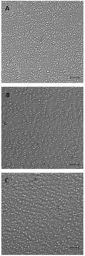 Figure 1. Platelets immobilized on plastic surface in 96-well plates. Washed platelets (0.5 x 108/ml) were not activated (a) or activated by 0.2 mM arachidonic acid (b) or 10 µm A23187 (C) without stirring for 5 min at room temperature and spun down on the bottom of 96-well plates (100 µl/well) at 1500 g, 5 min. (see “Materials and methods”). The supernatant was removed; platelets were fixed with 1% paraformaldehyde and analyzed in a phase-contrast microscope. Scale bar −10 µm. Close pictures were obtained after platelet activation by arachidonic acid (b) and ADP and collagen (not shown). After activation by A23187 most platelets acquire a rounded shape.