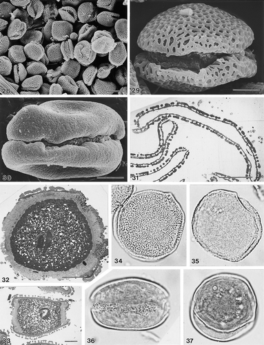 28–37. Other zonosulcate Areca pollen. 28, 29. A. chaiana Mohtar et al., S.49276 (SEM): (28) group of pollen grains at low magnification to show consistency of zonosulcate condition; (29) pollen grain in presumed equatorial view. 30. A. abdulrahmanii Jermy, 13702, pollen grain in presumed equatorial view (SEM). 31. A. chaiana Chai, S.33986, ultrathin section of acetolysed pollen grain (TEM). 32, 33. A. chaiana Mohtar et al., S.49276 (TEM): (32) ultrathin section through zonosulcus, presumed equatorial plane of unacetolysed grain; note thick and channelled intine I, and narrow, homogeneous intine II; (33) ultrathin section, presumed polar plane. (34) A. chaiana Chai, S.33986, pollen grain in high focus (LM). (35) A. andersonii Anderson, S.31937, pollen grain in high-mid focus (LM). (36, 37) A. abdulrahmanii Jermy, 13702; unacetolysed pollen grain (LM): (36) presumed equatorial view, mid-low focus; (37) presumed polar view, mid-low focus. LM Figs.: ×1000 (in 34–37). In SEM/TEM Figs. scale bars: 10 μm (in 29–33); 25 μm (in 28).