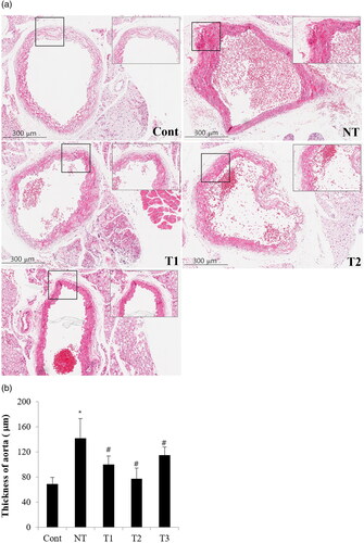 Figure 4. Effect of estradiol (E2) treatment on aortic thickness (μm) with different initiation time points and durations of HT.A. Transverse section of descending thoracic aorta of the study subjects. B. Comparison of aorta thickness among the study groups.Cont, control; NT, no estradiol treatment; T1, treatment group 1 with delayed estradiol treatment for 3 weeks; T2, treatment group 2 with on-time estradiol treatment for 6 weeks; T3, treatment group 3 with on-time estradiol treatment for 3 weeks. *P-value <0.001 (vs. Cont); #P-value <0.005 (vs. NT).