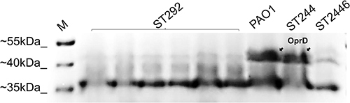 Figure 2 Out membrane profiling determined by SDS-PAGE; PAO1, reference P. aeruginosa strain; ST292, ST244, ST2446, representative clinical isolates. M, molecular size marker (Thermo). The arrow on the upper right indicates the banding position of OprD.