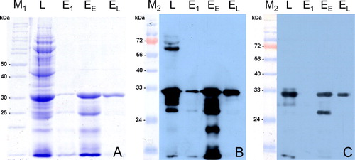 Figure 2.  Protein expression and purification of rCapPiCV. Level of rCapPiCV expression and purification steps were analysed by (2a) Coomassie staining, and western blot analysis using either (2b) an α-His antibody or (2c) sera of experimentally PiCV-infected pigeons. L, cleared lysate; E1, elution at pH 5.9; EE, early elution fractions at pH 4.5; EL, late elution fractions at pH 4.5; M1 and M2, protein markers, respective molecular weights given by numbers.