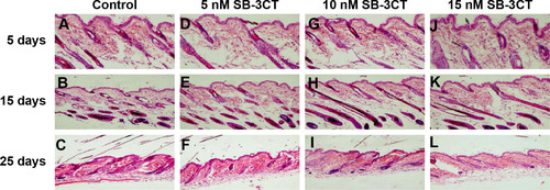 Figure 4 Effect of topical application of the collagenase IV inhibitor on hair follicles.