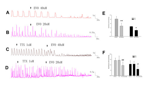 Figure 5 The effect of EVO and TTX on colonic strips after removing the mucosa and submucosa. (A and B) The inhibitory effect of EVO on LM and CMs trips after removing the mucosa and submucosa still exists. (C and D) The inhibitory effects of EVO on colonic strips cannot be blocked by TTX after removing the mucosa and submucosa. (E) Summarized results of colonic contractile activities induced by EVO after removing the mucosa and submucosa. (F) Summarized results of the TTX on inhibitory contraction of colonic strips induced by EVO after removing the mucosa and submucosa. *P<0.05 vs normal; **P<0.01 vs normal; N=5/group. #P<0.05 vs TTX; ##P<0.01 vs TTX; N=3/group.