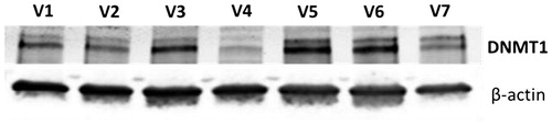 Figure 4. DNMT1 expression in white blood cells from 7 human volunteers (V1-V7) as determined with western blotting equal amounts of protein were used for each sample. β-actin was used as a loading control.