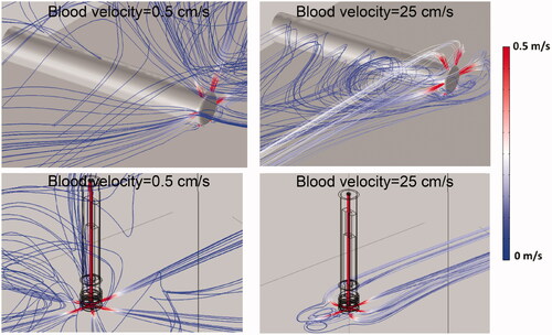 Figure 7. Streamline plots visualize irrigation. Flow velocity profile and the direction of saline exiting the catheter (30 ml/min irrigation flow rate). Results are shown for the perpendicular catheter orientation (upper images) and for the parallel orientation (lower images), for blood flow velocities of 0.5 cm/s and 25 cm/s as indicated, with blood flow direction from the upper right.