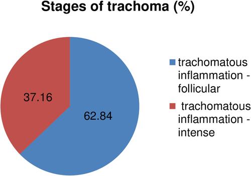 Figure 1 Stages of trachoma observed in pre-school children in AM-HDSS, Southern Ethiopia from May 01 to June 16, 2019.