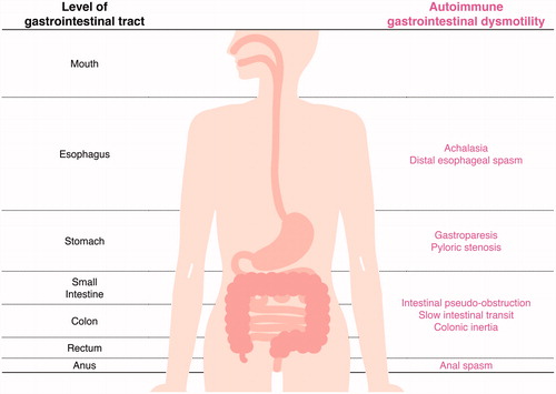 Figure 1. Autoimmune gastrointestinal dysmotility (AGID). AGID and the corresponding parts affected in the GI tract have been listed.