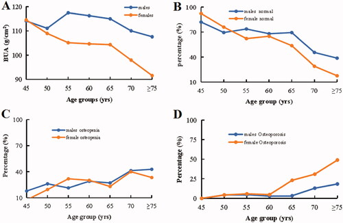 Figure 1. The change of bone mass with age of senior and middle-aged Mulao people. (A) BMD. (B) Normal. (C) Osteopenia. (D) OP.