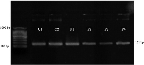 Figure 2. Quantitative expression of βA mRNA in control (C) and drug-free patients (P1 and P2) and treated ones (P3 and P4).