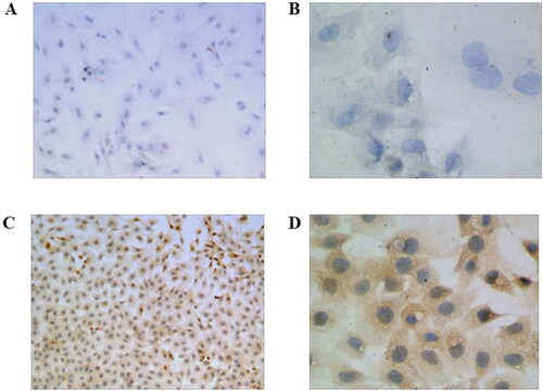 Figure 3. Immunohistochemical detection of PTH expression level. HUMSCs, 100X (A) and 400X (B); Gene edited HUMSCs, 100X (C) and 400X (D).