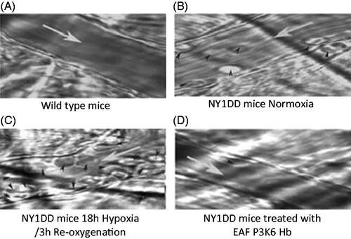 Figure 6 The intravital microscopic images of venules from transgenic sickle cell mice (NYIDD) subjected to hypoxia-reoxygenation protocol and treated with EAF P3K6 Hb after hypoxia.
