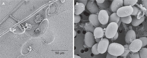 Figure 2 Scanning electron micrograph of L. ramosa CBS124198. The characteristic sporangiophores with circinate side branches (A) and ellipsoid sporangiospores (B) were observed.