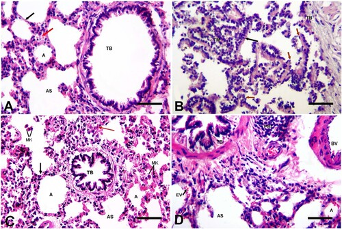 Figure 3. The transverse section in the lungs of the study groups (H&E stain). (A) The CON group shows normal lung histo-architecture; terminal bronchiole (TB), alveolar sac (AS), alveoli (A), thin inter-alveolar septum (black arrow) and thick interstitial tissue (red arrow). (B) The URT group showing papillary adenocarcinoma in the lumen of a terminal bronchiole (TB) formed of tumour mass (TM) of irregular papillae lined by hyperplastic columnar epithelial cells with basal vesicular nuclei (black arrow) with some pleomorphic cells differ in their shape and size (brown arrows). (C) The URT + PE-treated group shows terminal bronchiole (TB), alveolar sac (AS), variable-sized alveoli (A), thin inter-alveolar septum (black arrow), moderate thickened interstitial tissue (red arrow), some macrophages (MK) in the lung parenchyma. (D) The URT + CIS-treated group shows terminal bronchiole (TB), alveolar sac (AS), alveoli (A), thickened BV, peri-bronchial inflammation (PBI), RBCs extravasation (EV). Bar = 50 µm.