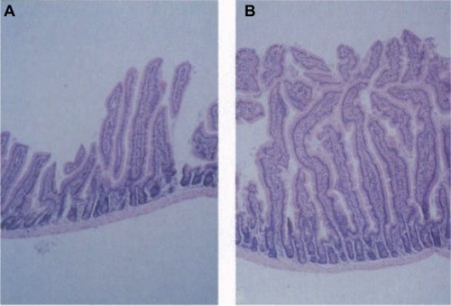 Figure 2 Effect of GLP-2 on murine small intestine. Histological appearance of small intestine epithelium from control (A) and GLP-2-injected (10 days) (B) mice. Reproduced with permission from Drucker et al.Citation11© Copyright 1996 National Academy of Sciences, USA.