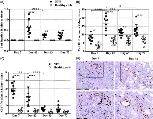 Figure 2. A time course evaluation of morphological changes in the passive NTN model. (A) Scatter plot is showing semi-quantification of Perl positive area in the cortex area. (B) Scatter plot is showing semi-quantification of Collagen III positive area in the cortex area. (C) Scatter plot is showing semi-quantification of the Ki-67 positive area in the cortex area. (D) Representative images are showing the Ki-67 positive area in the cortex area. Data are shown as mean ± SD. **p < .01, ****p < .0001 NTN groups vs. healthy control groups and, #p < .05, ##p < .01, ###p < .001 ####p < .0001 NTN group vs. NTN group by one-way ANOVA using Tukey’s multiple comparisons test (n = 10).