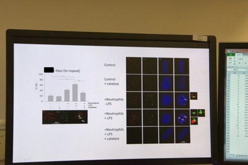 Picture 1. Aligning visualization and quantification [Photo by author].