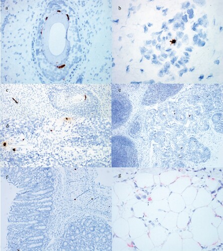 Figure 4. Detection of PCV3 by ISH in weaned pig cases. (a) PCV3 in hair follicle epithelium of the 3-week-old pig from Case no. 2. (b) PCV3 in an endothelial cell of a small arteriole in the dermis of the 3-week-old pig from Case no. 2. (c) PCV3 in cardiac myocytes and smooth muscle of an arteriole surrounded by inflammation in the 25-day-old pig from Case no. 7. (d) PCV3 in smooth muscle of an arteriole surrounded by inflammation in a 6-week-old pig from Case no. 8. (e) PCV3 in smooth muscle of multiple arterioles surrounded by inflammation and gut-associated lymphoid tissue of the 25-day-old pig from Case no. 7. PCV3 in the (f) smooth muscle and lamina propria of the large intestine and (g) adipocytes of the panniculus of the 3-week-old pig from Case no. 2.