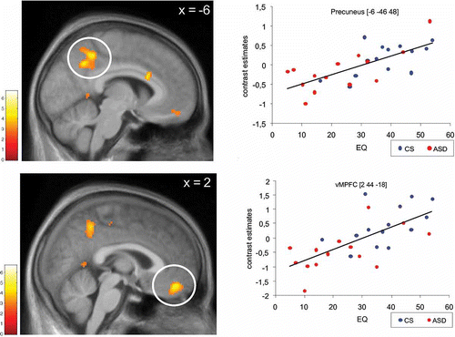 Figure 3. Covariation of brain activation and empathic abilities. Brain activity during the other task (vs. high-level baseline) correlated with individual EQ values (Baron-Cohen and Wheelwright, Citation2004) across all participants. SPM is thresholded at p < .005 (voxel-level). Circled clusters are significant at p < .05, corrected for multiple comparisons at the cluster level. Scatterplots illustrate the correlation in the peak activated voxels of both significant clusters in vMPFC and precuneus, respectively. Solid lines represent the linear best fit.
