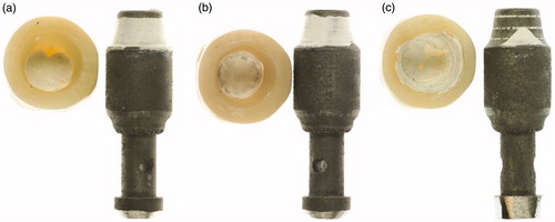Figure 2. Crowns de-bonded from implant substitutes when the insides of the crowns are (a) sandblasted, (b) ground and (c) melt-etched with potassium hydrogen difluoride.