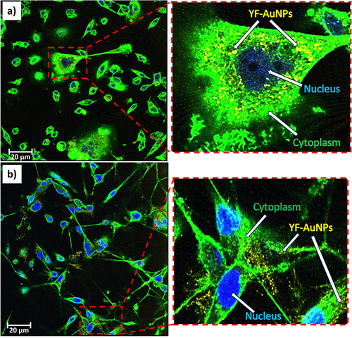 Figure 8 Confocal microscopy images of YF-AuNPs (50 μg/mL): cellular internalization in (a) PC-3 and (b) MDAMB-231 cells after 24 hr incubation. The cytoplasm (green – WGA labeling), nucleus (blue – DAPI stain) and YF-AuNPs (yellow) seen.