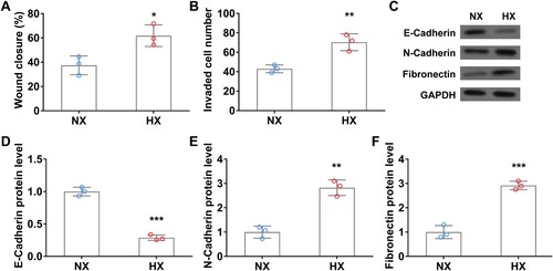 Figure 3. Hypoxia promotes the migration and invasion of A549 cells in vitro. Wound closure rate (A) and cell invasion number (B) of A549 cells in wound healing assay and transwell invasion assay under normoxia (NX) and hypoxia (HX) conditions for the first 24 h. C–F, The protein level of EMT-related protein E-Cadherin (C and D), N-Cadherin (C and E), and Fibronectin (C and F) in A549 cells under normoxia (NX) and hypoxia (HX) condition for 24 h. n = 3 wells.