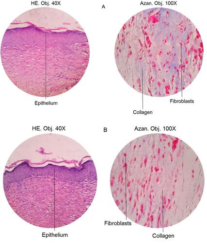 Figure 5 The results of skin histopathology analysis using Mallory-azan staining at 40x and 100x magnification in (A) control mice and (B) mice treated with 75 µg/mL hEGF.