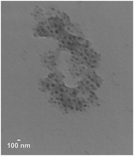 Figure 5 Transmission electron microscopy. The TEM image of dendriplexes formed with PAMAM and pG-CX-bF-PE.