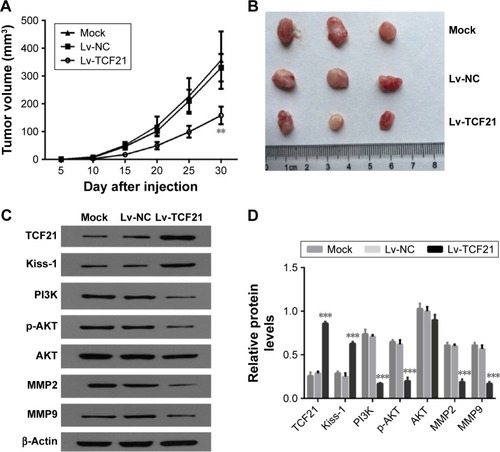 Figure 6 TCF21 suppresses tumorigenicity of human colorectal cancer cells in vivo.
