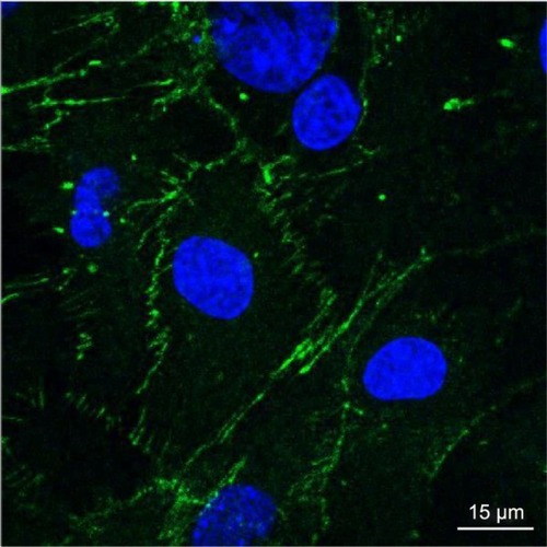 Figure 7 Essential junction proteins expressed by b.End3 when cocultured with astrocytes.Notes: Cells were stained with anti-ZO1-conjugated FITC (green) and counterstained with DAPI (blue). Magnification 40×.Abbreviations: FITC, fluorescein isothiocyanate; b.End3, mouse brain endothelial cell.