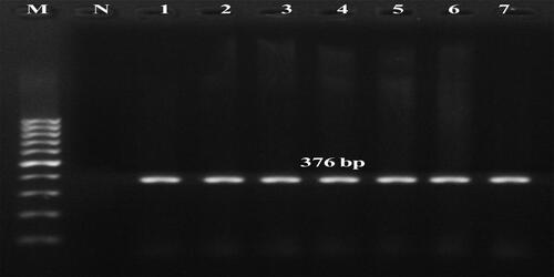 Figure 4. Molecular detection of FMDV type A by multiplex RT-PCR in tissue samples of calves. Lane M–100 bp + DNA ladder, N-negative control, Lane 1–7 amplicons positive for Type A (376 bp), L1-Tongue, cattle calf, case 1, L2-Heart, cattle calf, case 4, L3- Tongue, buffalo calf, case 8, L4- Heart, case 9, L5- Tongue, buffalo calf, case 9, L6- Heart, buffalo calf, case 9, L7-Heart, cattle calf, case 7.